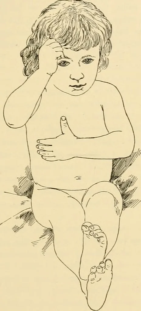 An illustration from Pediatrics : the hygienic and medical treatment of children / by Thomas Morgan Rotch., 1898, leaf 767