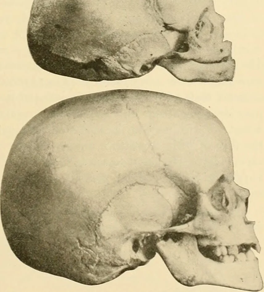 An illustration from Pediatrics : the hygienic and medical treatment of children / by Thomas Morgan Rotch., 1898, leaf 77
