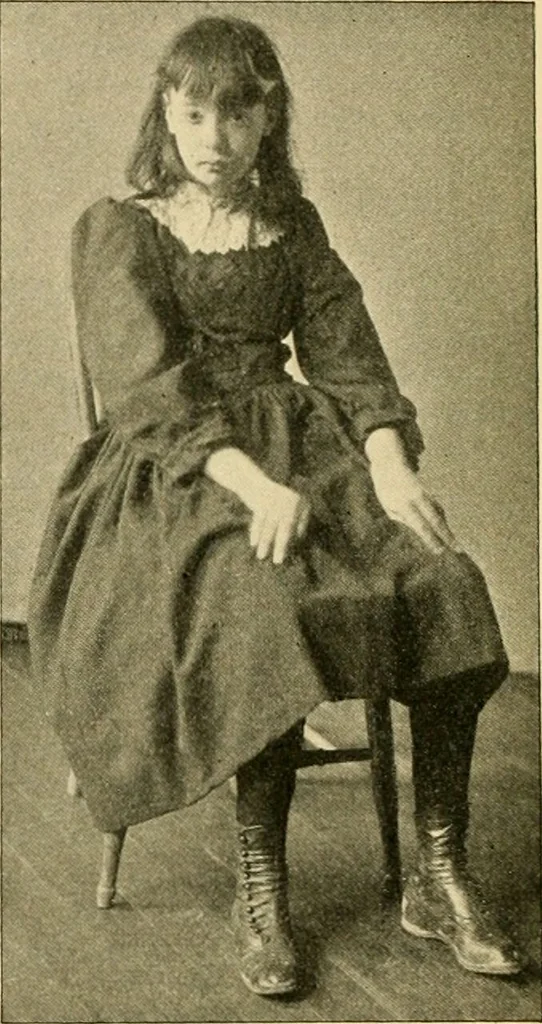 An illustration from Pediatrics : the hygienic and medical treatment of children / by Thomas Morgan Rotch., 1898, leaf 774