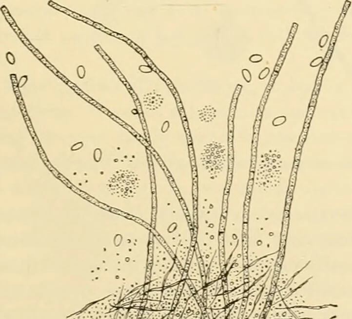 An illustration from Pediatrics : the hygienic and medical treatment of children / by Thomas Morgan Rotch., 1898, leaf 847