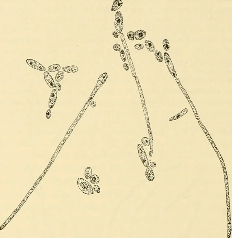 An illustration from Pediatrics : the hygienic and medical treatment of children / by Thomas Morgan Rotch., 1898, leaf 848