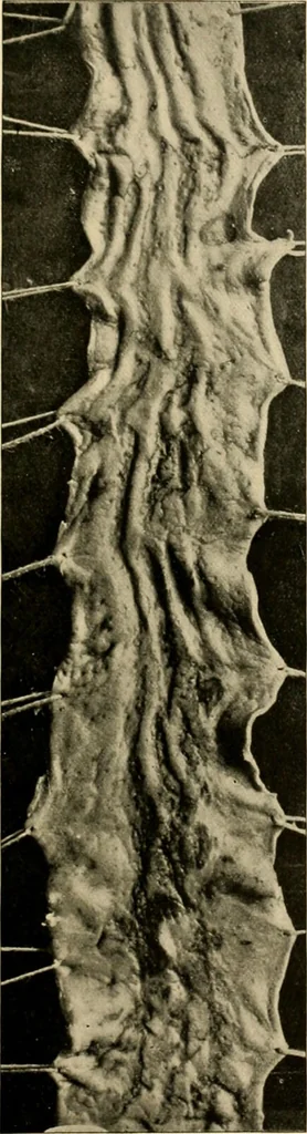 An illustration from Pediatrics : the hygienic and medical treatment of children / by Thomas Morgan Rotch., 1898, leaf 901