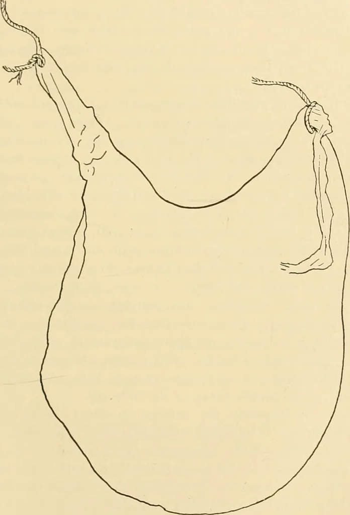 An illustration from Pediatrics : the hygienic and medical treatment of children / by Thomas Morgan Rotch., 1898, leaf 913