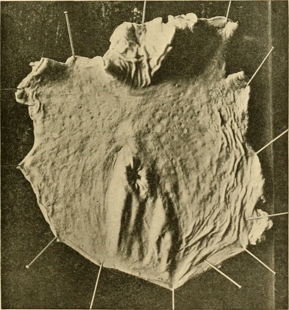 An illustration from Pediatrics : the hygienic and medical treatment of children / by Thomas Morgan Rotch., 1898, leaf 917