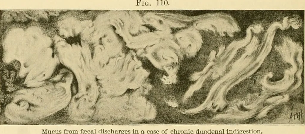 An illustration from Pediatrics : the hygienic and medical treatment of children / by Thomas Morgan Rotch., 1898, leaf 928