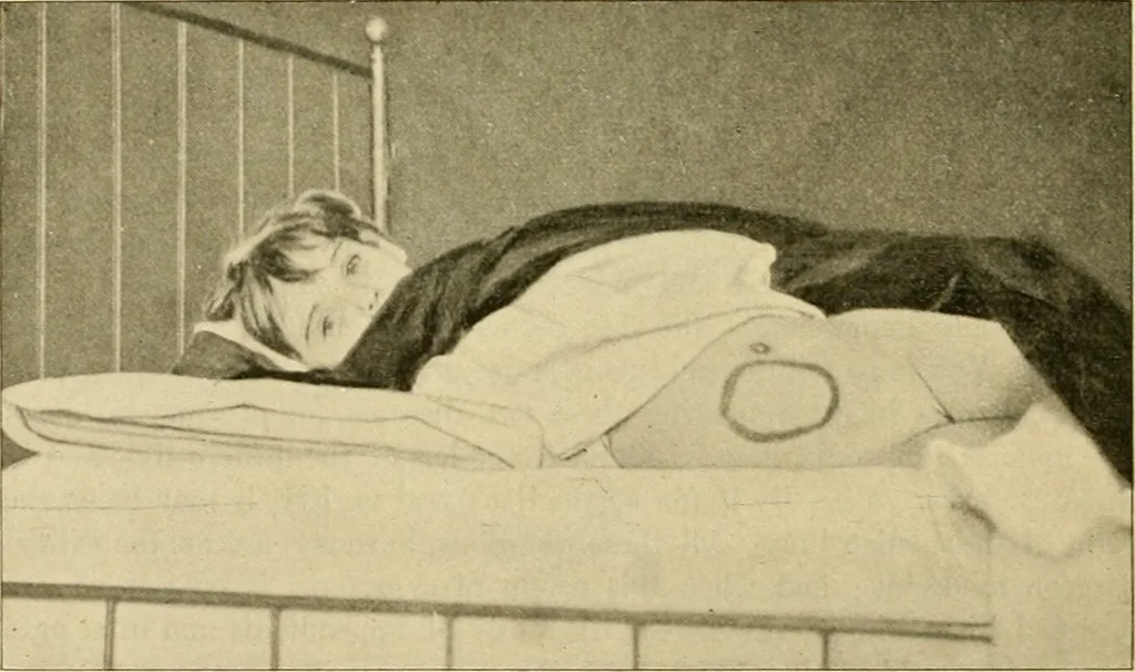 An illustration from Pediatrics : the hygienic and medical treatment of children / by Thomas Morgan Rotch., 1898, leaf 954