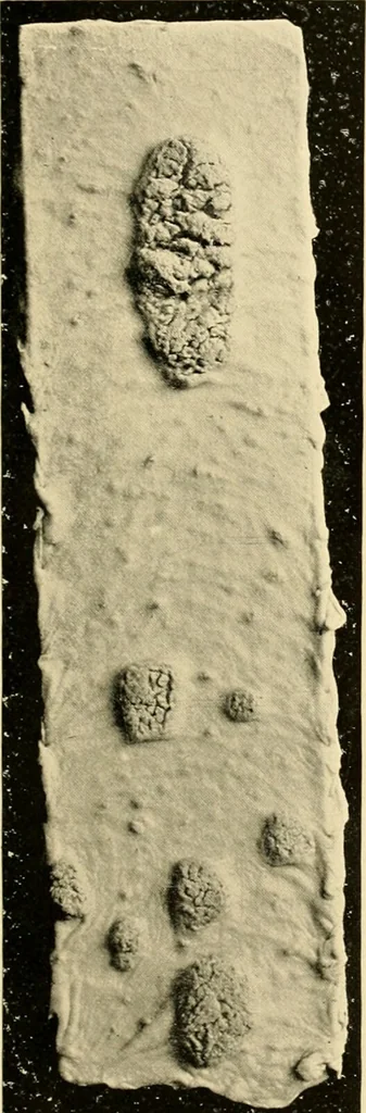 An illustration from Pediatrics : the hygienic and medical treatment of children / by Thomas Morgan Rotch., 1898, leaf 957