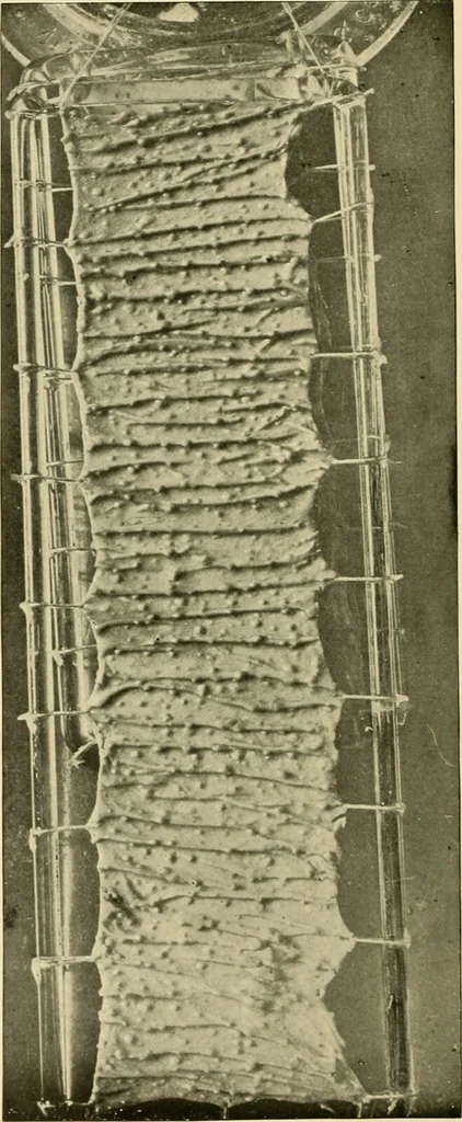 An illustration from Pediatrics : the hygienic and medical treatment of children / by Thomas Morgan Rotch., 1898, leaf 958