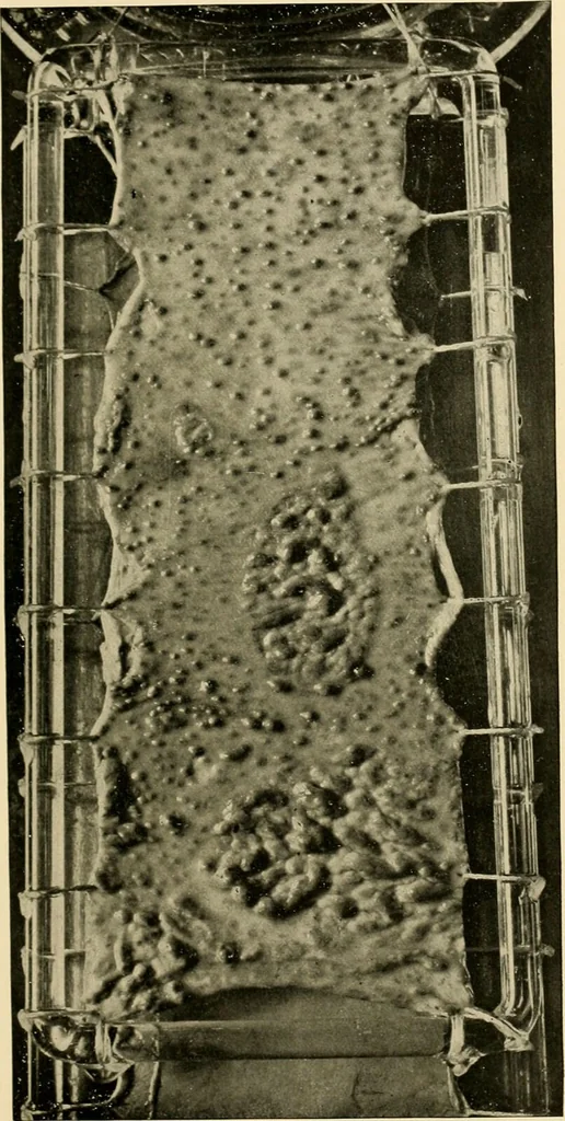 An illustration from Pediatrics : the hygienic and medical treatment of children / by Thomas Morgan Rotch., 1898, leaf 959