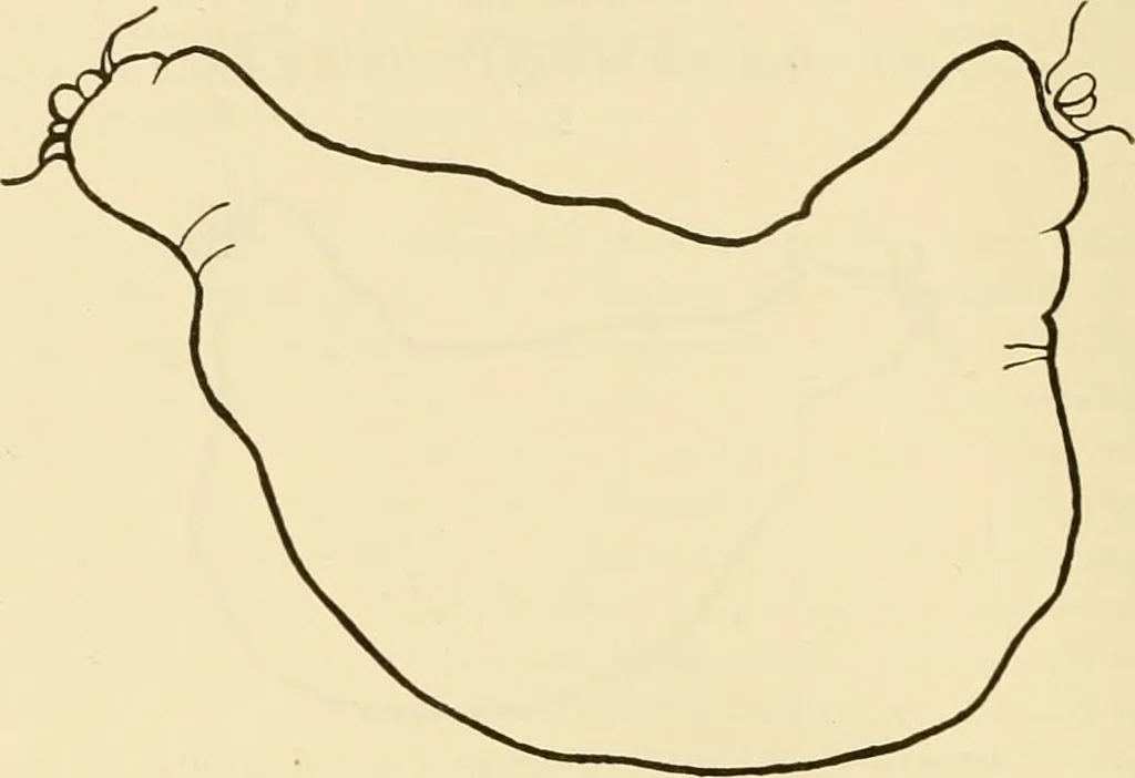 An illustration from Pediatrics : the hygienic and medical treatment of children / by Thomas Morgan Rotch., 1898, leaf 96