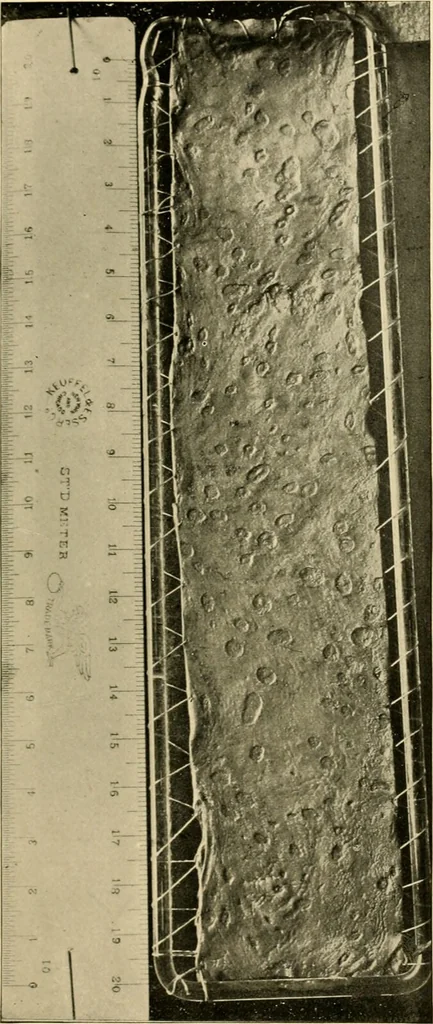 An illustration from Pediatrics : the hygienic and medical treatment of children / by Thomas Morgan Rotch., 1898, leaf 961