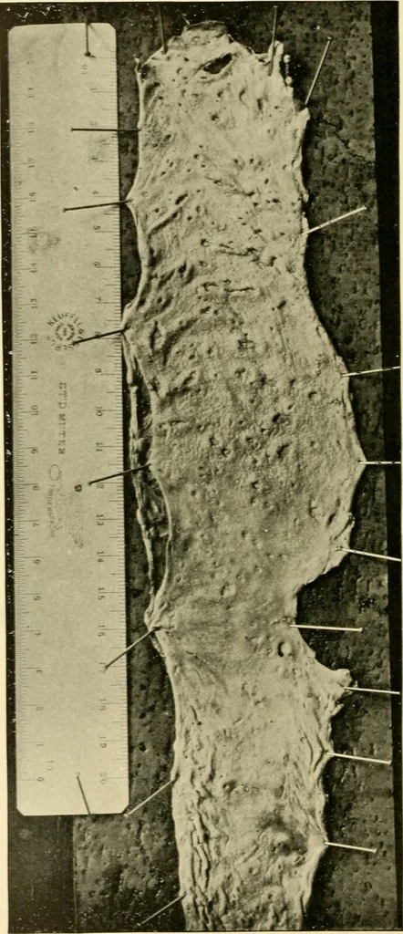 An illustration from Pediatrics : the hygienic and medical treatment of children / by Thomas Morgan Rotch., 1898, leaf 962
