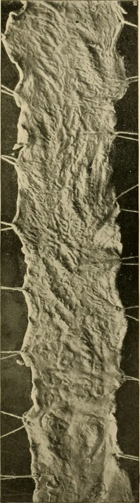 An illustration from Pediatrics : the hygienic and medical treatment of children / by Thomas Morgan Rotch., 1898, leaf 965