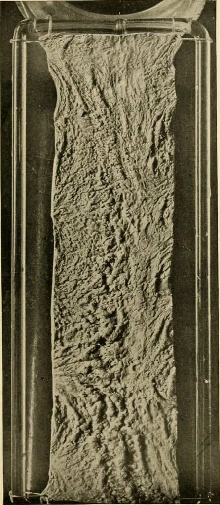 An illustration from Pediatrics : the hygienic and medical treatment of children / by Thomas Morgan Rotch., 1898, leaf 967