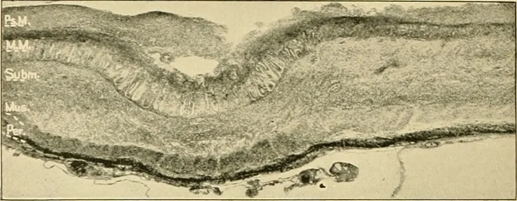 An illustration from Pediatrics : the hygienic and medical treatment of children / by Thomas Morgan Rotch., 1898, leaf 968