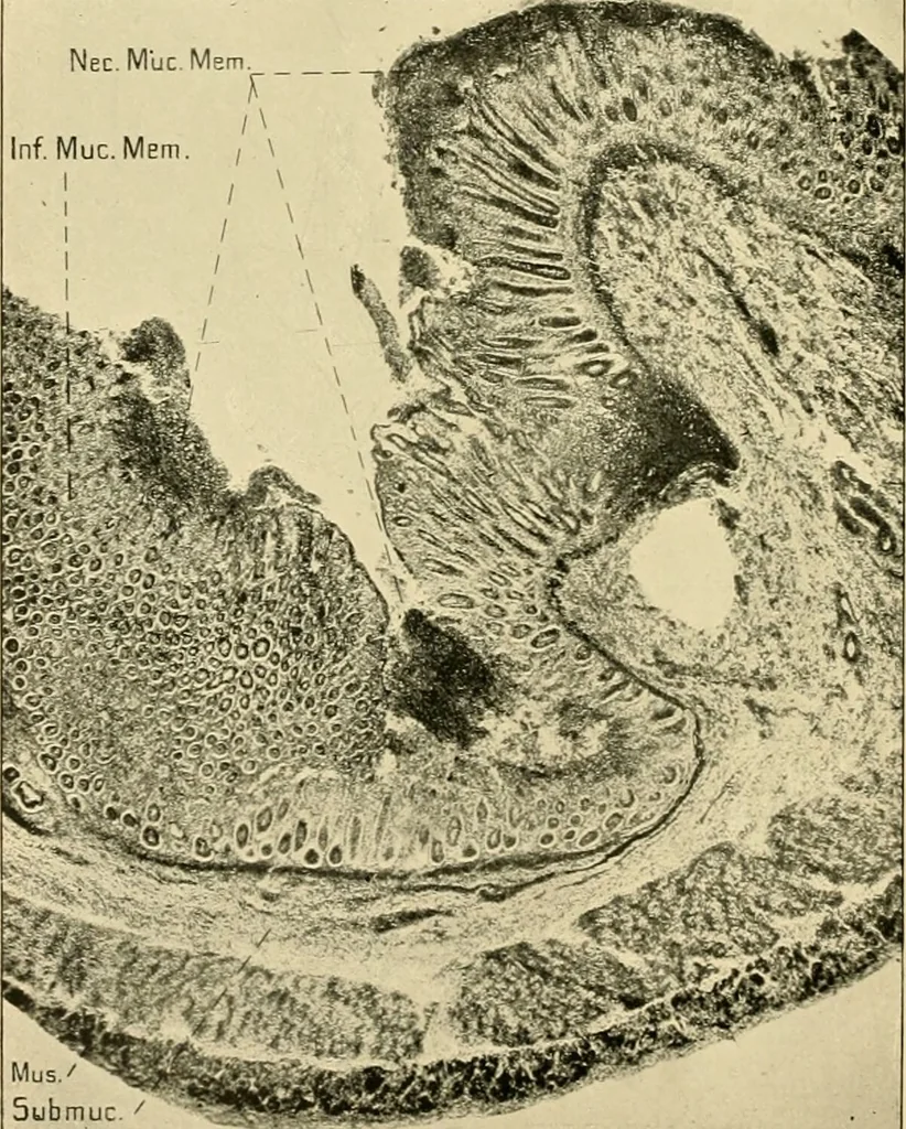An illustration from Pediatrics : the hygienic and medical treatment of children / by Thomas Morgan Rotch., 1898, leaf 968