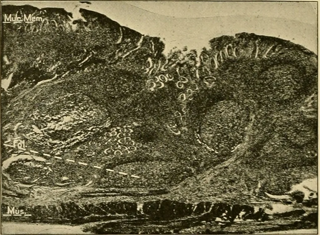 An illustration from Pediatrics : the hygienic and medical treatment of children / by Thomas Morgan Rotch., 1898, leaf 982