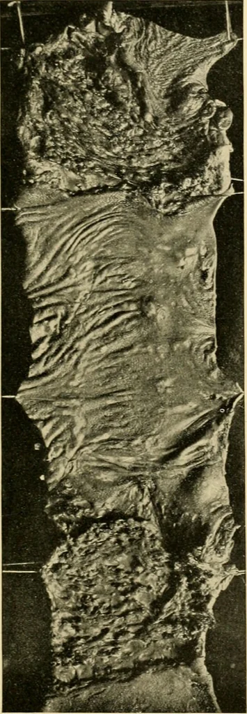 An illustration from Pediatrics : the hygienic and medical treatment of children / by Thomas Morgan Rotch., 1898, leaf 983