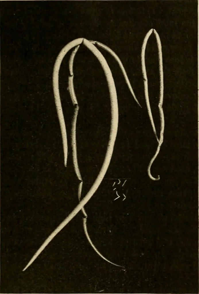 An illustration from Pediatrics : the hygienic and medical treatment of children / by Thomas Morgan Rotch., 1898, leaf 987
