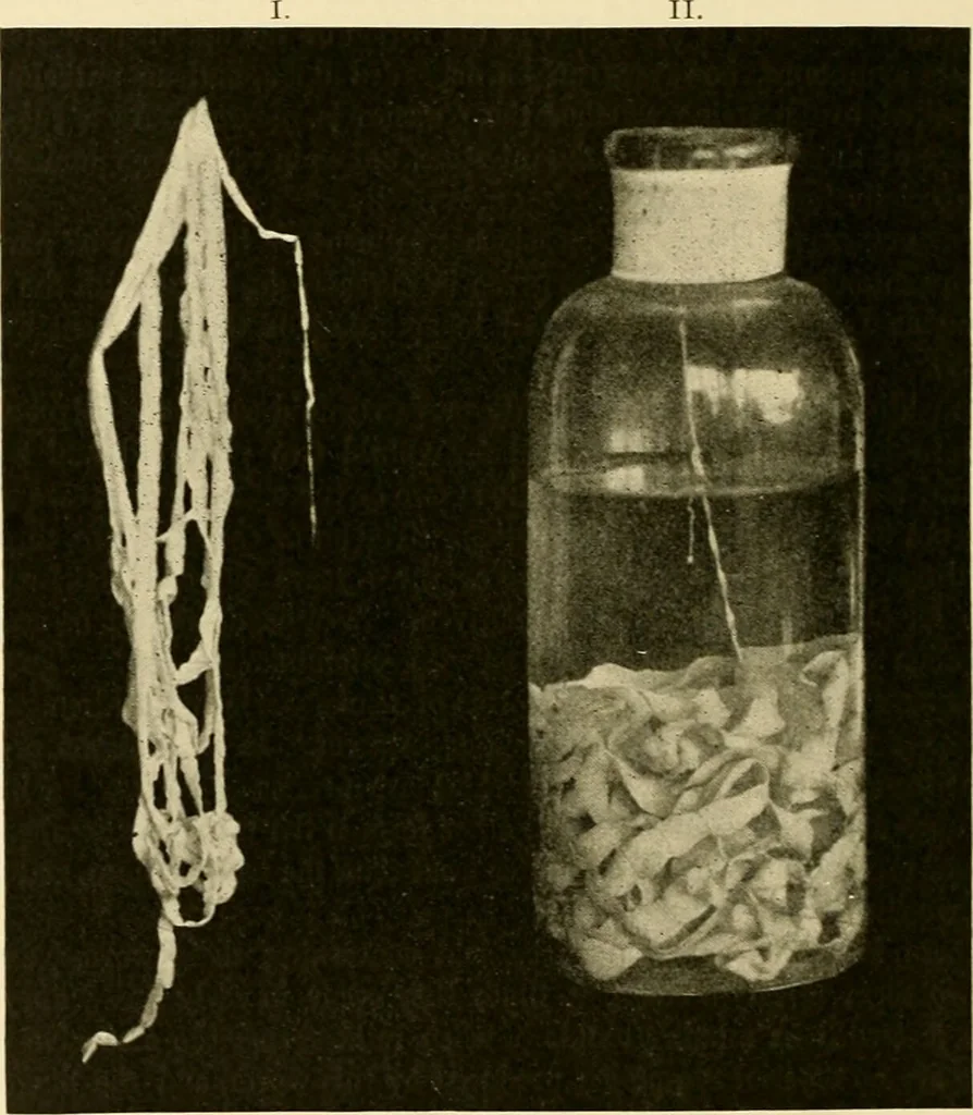 An illustration from Pediatrics : the hygienic and medical treatment of children / by Thomas Morgan Rotch., 1898, leaf 990