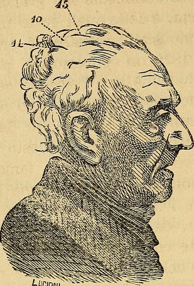 An illustration from Questioni filosofiche, sociali, mediche e medico-forensi : trattate coi principii della fisiologia del cervello / pel Dottore Biagio G. Miraglia., 1883, leaf 212
