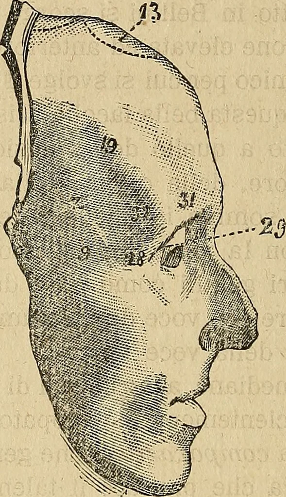 An illustration from Questioni filosofiche, sociali, mediche e medico-forensi : trattate coi principii della fisiologia del cervello / pel Dottore Biagio G. Miraglia., 1883, leaf 308