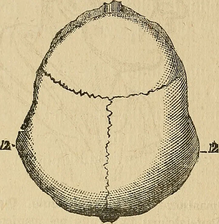 An illustration from Questioni filosofiche, sociali, mediche e medico-forensi : trattate coi principii della fisiologia del cervello / pel Dottore Biagio G. Miraglia., 1883, leaf 446