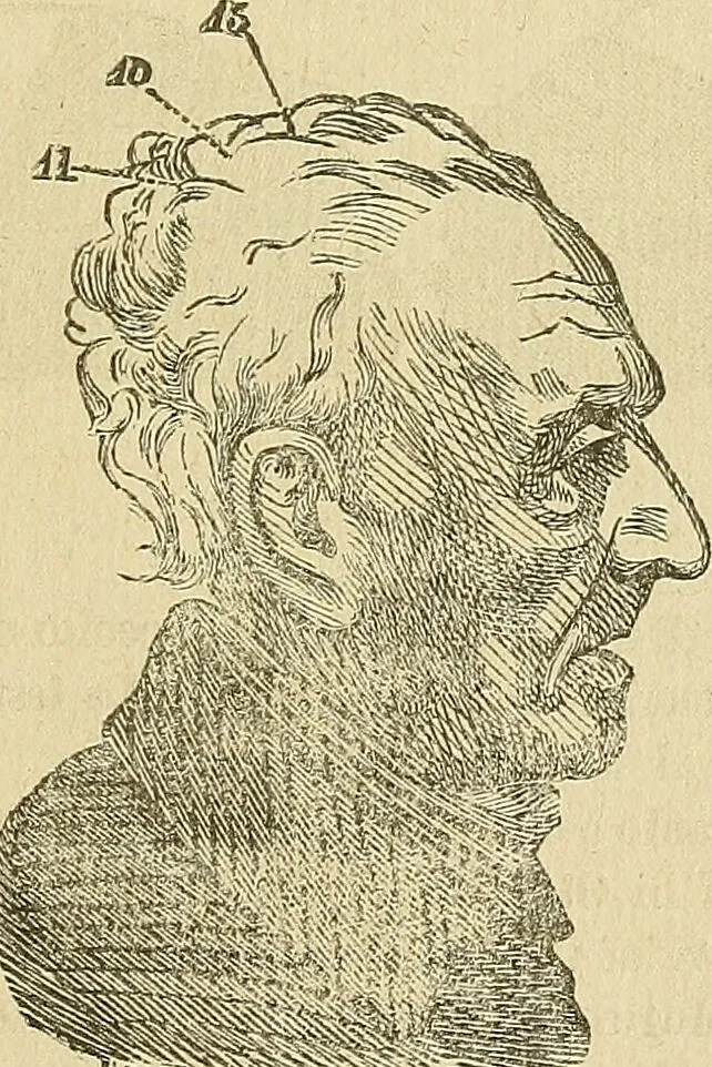 An illustration from Questioni filosofiche, sociali, mediche e medico-forensi : trattate coi principii della fisiologia del cervello / pel Dottore Biagio G. Miraglia., 1883, leaf 447