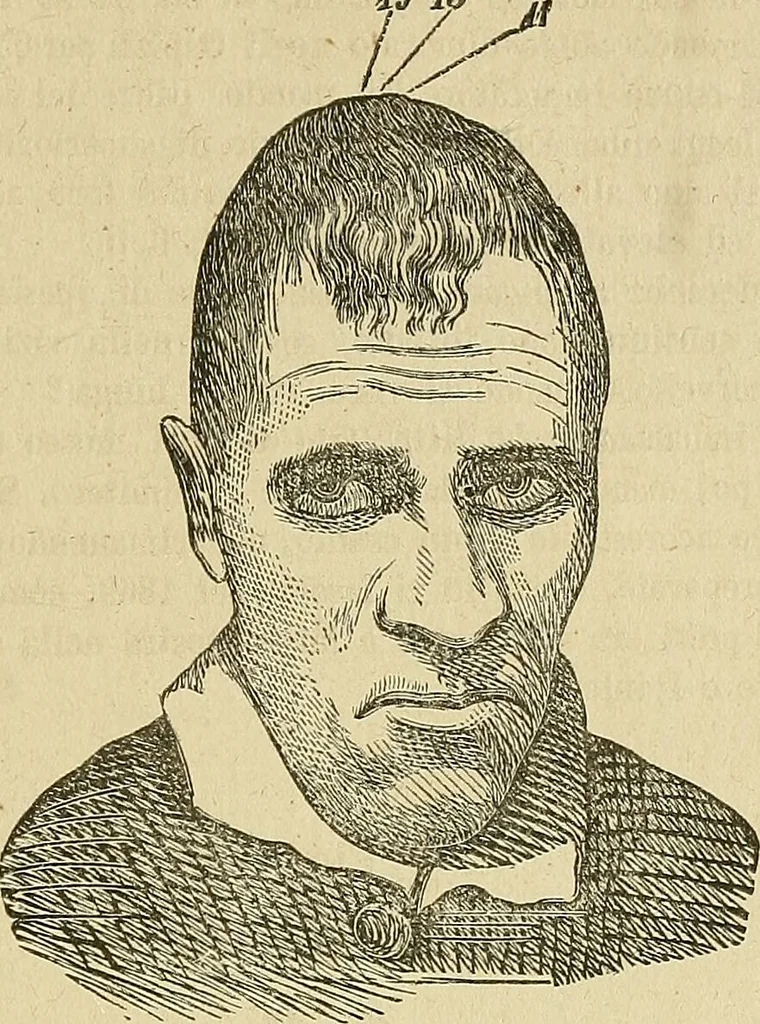 An illustration from Questioni filosofiche, sociali, mediche e medico-forensi : trattate coi principii della fisiologia del cervello / pel Dottore Biagio G. Miraglia., 1883, leaf 449