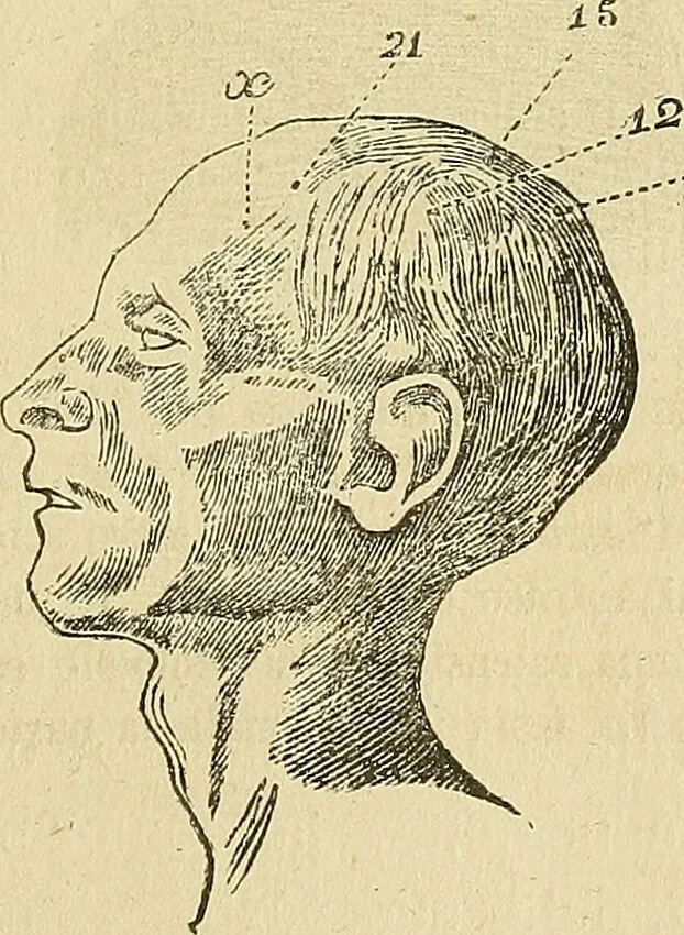 An illustration from Questioni filosofiche, sociali, mediche e medico-forensi : trattate coi principii della fisiologia del cervello / pel Dottore Biagio G. Miraglia., 1883, leaf 451