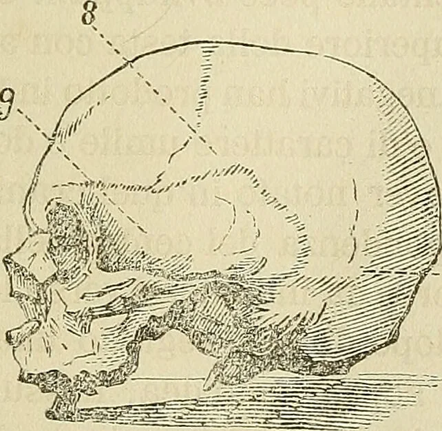 An illustration from Questioni filosofiche, sociali, mediche e medico-forensi : trattate coi principii della fisiologia del cervello / pel Dottore Biagio G. Miraglia., 1883, leaf 95
