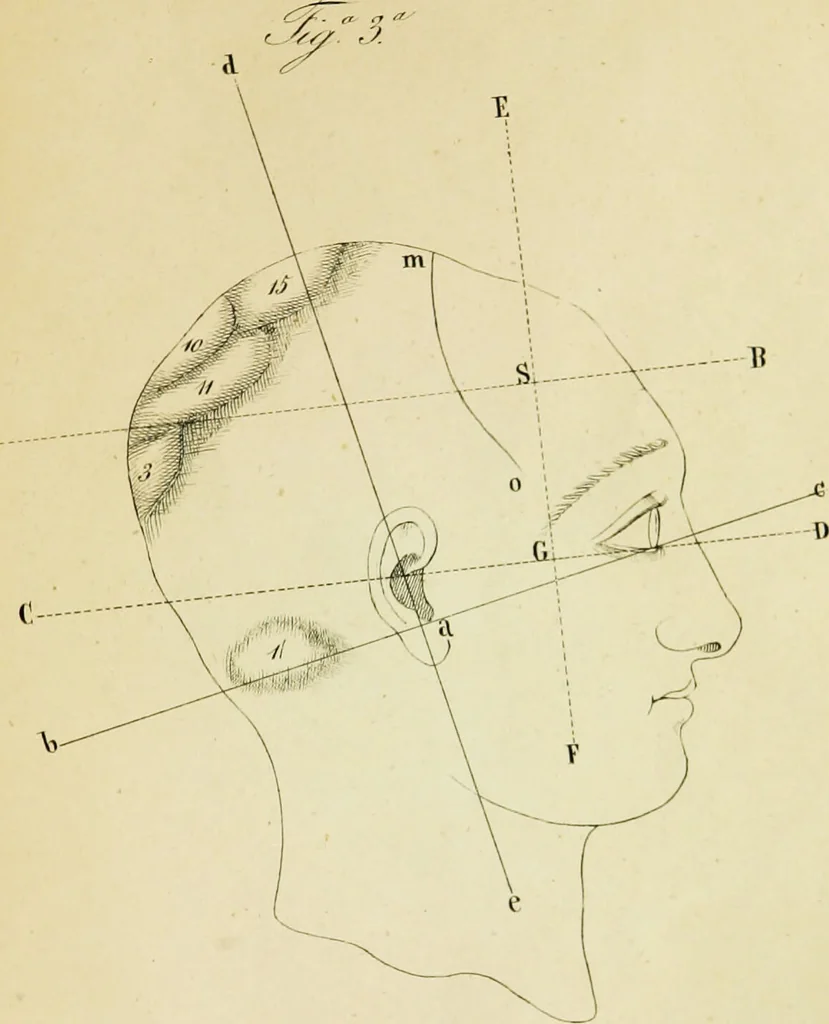 An illustration from Cenno su di una nuova classificazione e di una nuova statistica delle alienazioni mentali, fondate su principì frenologici considerati nei loro rapporti con la patologia del cervello, del Biagio G. Miraglia., 1847, leaf 91