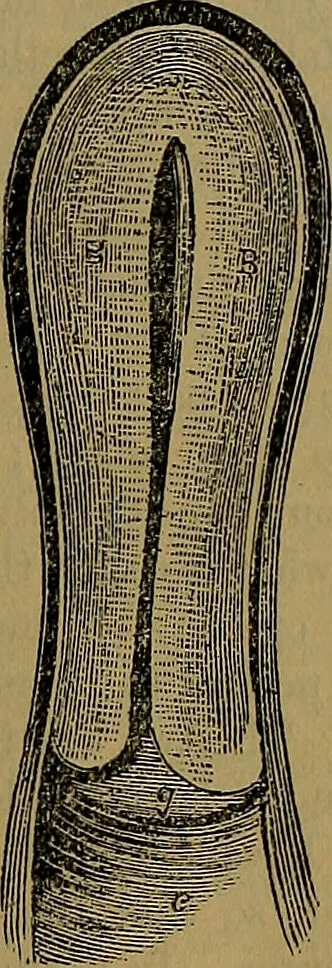 An illustration from The origin of life and process of reproduction in plants and animals : with the anatomy and physiology of the human generative system, male and female, and the causes, prevention and cure of the special diseases to which it is liable : a plain, practical treatise, for popular use / by Dr. F. Hollick ; illustrated by engravings and colored plates., 1902, leaf 293