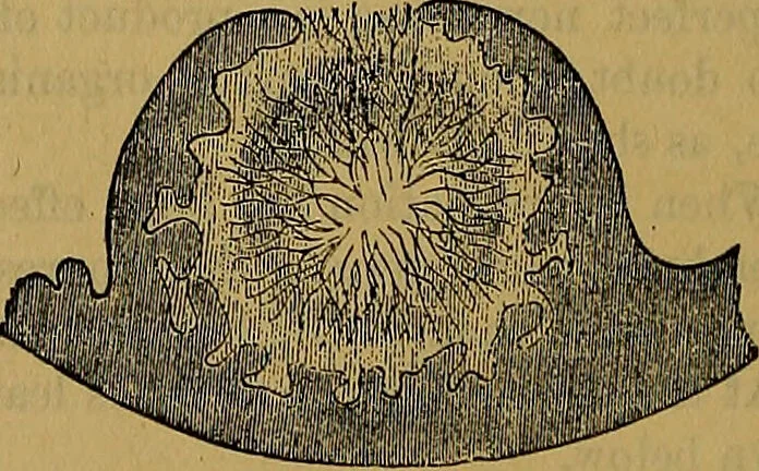 An illustration from The origin of life and process of reproduction in plants and animals : with the anatomy and physiology of the human generative system, male and female, and the causes, prevention and cure of the special diseases to which it is liable : a plain, practical treatise, for popular use / by Dr. F. Hollick ; illustrated by engravings and colored plates., 1902, leaf 370