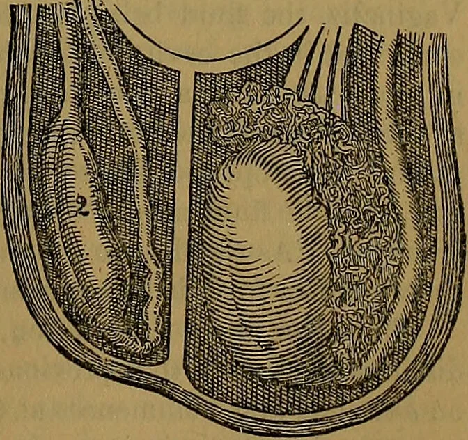 An illustration from The origin of life and process of reproduction in plants and animals : with the anatomy and physiology of the human generative system, male and female, and the causes, prevention and cure of the special diseases to which it is liable : a plain, practical treatise, for popular use / by Dr. F. Hollick ; illustrated by engravings and colored plates., 1902, leaf 589