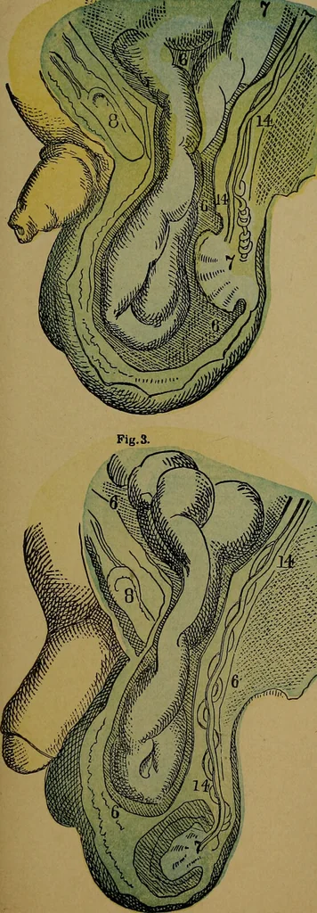 An illustration from The origin of life and process of reproduction in plants and animals : with the anatomy and physiology of the human generative system, male and female, and the causes, prevention and cure of the special diseases to which it is liable : a plain, practical treatise, for popular use / by Dr. F. Hollick ; illustrated by engravings and colored plates., 1902, leaf 703