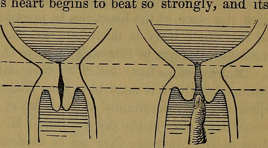 An illustration from The origin of life and process of reproduction in plants and animals : with the anatomy and physiology of the human generative system, male and female, and the causes, prevention and cure of the special diseases to which it is liable : a plain, practical treatise, for popular use / by Dr. F. Hollick ; illustrated by engravings and colored plates., 1902, leaf 883