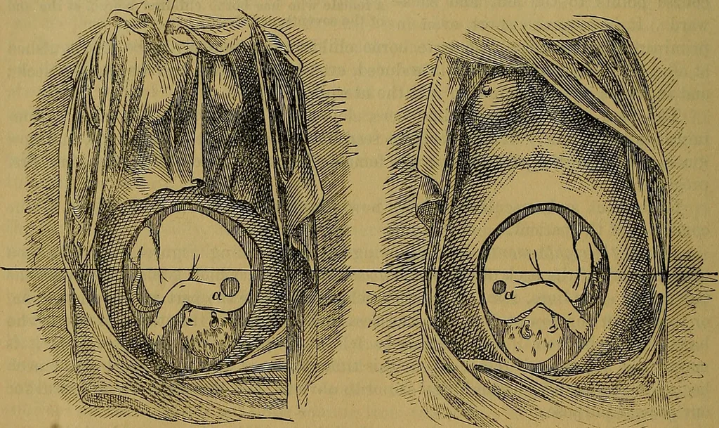 An illustration from The origin of life and process of reproduction in plants and animals : with the anatomy and physiology of the human generative system, male and female, and the causes, prevention and cure of the special diseases to which it is liable : a plain, practical treatise, for popular use / by Dr. F. Hollick ; illustrated by engravings and colored plates., 1902, leaf 886