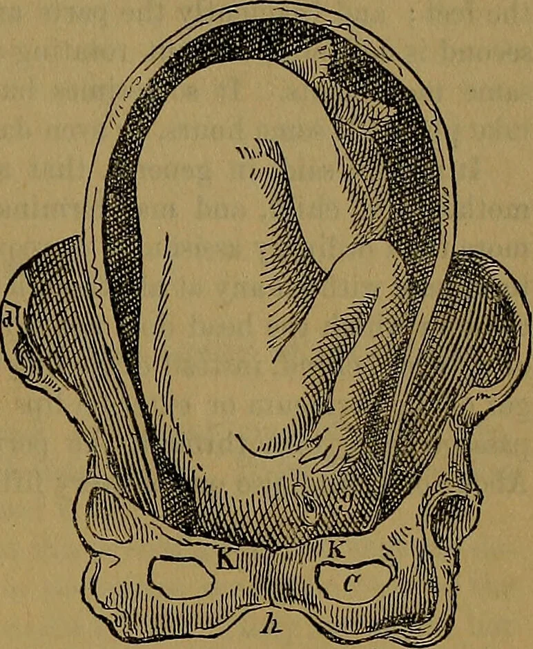 An illustration from The origin of life and process of reproduction in plants and animals : with the anatomy and physiology of the human generative system, male and female, and the causes, prevention and cure of the special diseases to which it is liable : a plain, practical treatise, for popular use / by Dr. F. Hollick ; illustrated by engravings and colored plates., 1902, leaf 907