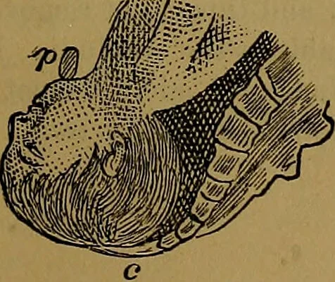 An illustration from The origin of life and process of reproduction in plants and animals : with the anatomy and physiology of the human generative system, male and female, and the causes, prevention and cure of the special diseases to which it is liable : a plain, practical treatise, for popular use / by Dr. F. Hollick ; illustrated by engravings and colored plates., 1902, leaf 915