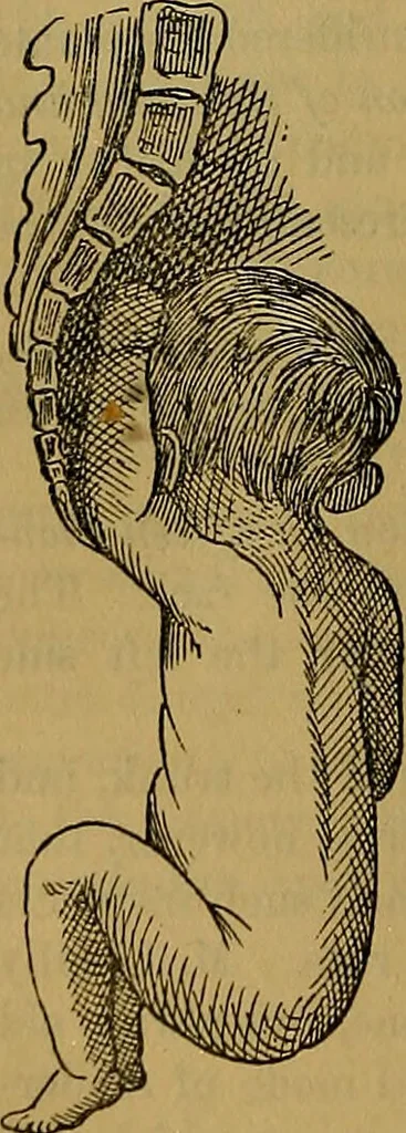 An illustration from The origin of life and process of reproduction in plants and animals : with the anatomy and physiology of the human generative system, male and female, and the causes, prevention and cure of the special diseases to which it is liable : a plain, practical treatise, for popular use / by Dr. F. Hollick ; illustrated by engravings and colored plates., 1902, leaf 918