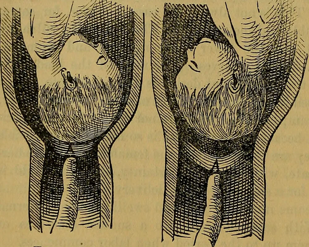 An illustration from The origin of life and process of reproduction in plants and animals : with the anatomy and physiology of the human generative system, male and female, and the causes, prevention and cure of the special diseases to which it is liable : a plain, practical treatise, for popular use / by Dr. F. Hollick ; illustrated by engravings and colored plates., 1902, leaf 922
