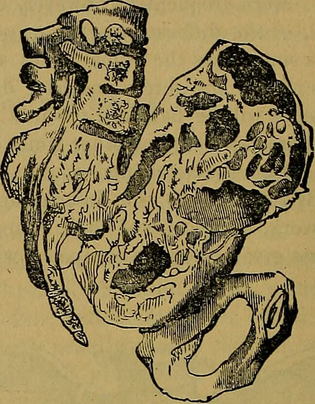 An illustration from The origin of life and process of reproduction in plants and animals : with the anatomy and physiology of the human generative system, male and female, and the causes, prevention and cure of the special diseases to which it is liable : a plain, practical treatise, for popular use / by Dr. F. Hollick ; illustrated by engravings and colored plates., 1902, leaf 948