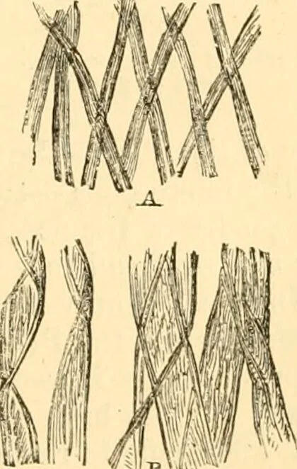 An illustration from The microscope : its history, construction, and application, being a familiar introduction to the use of the instrument, and the study of microscopial science / By Jabez Hogg ... with upwards of five hundred engravings and coloured illustrations by Tuffen West., 1867, leaf 383