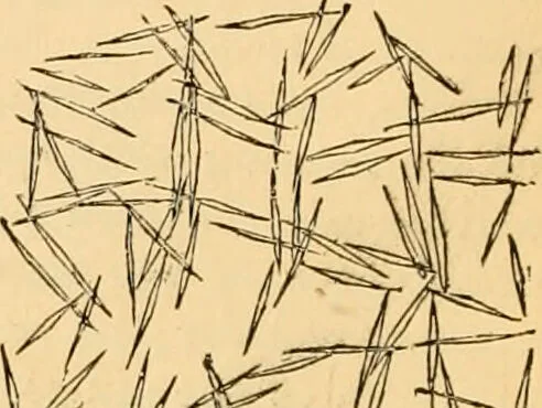 An illustration from The microscope : its history, construction, and application, being a familiar introduction to the use of the instrument, and the study of microscopial science / By Jabez Hogg ... with upwards of five hundred engravings and coloured illustrations by Tuffen West., 1867, leaf 418