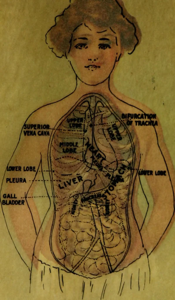 An illustration from Tuberculosis and allied diseases : an account of their origin and treatment from the earliest times up to and including the present / by Freeman Hall .., 1912, leaf 31