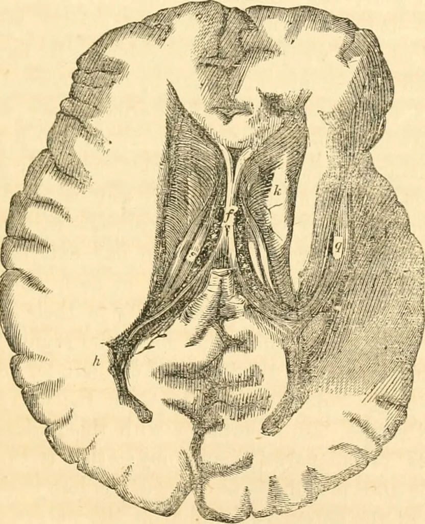An illustration from The mysteries of human nature explained by a new system of nervous physiology : to which is added, a review of the errors of spiritualism, and instructions for developing or resisting the influence by which subjects and mediums are made / by J. Stanley Grimes., 1860, leaf 165