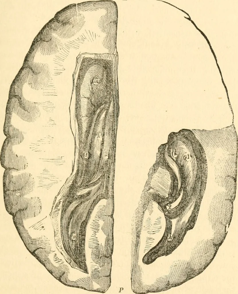 An illustration from The mysteries of human nature explained by a new system of nervous physiology : to which is added, a review of the errors of spiritualism, and instructions for developing or resisting the influence by which subjects and mediums are made / by J. Stanley Grimes., 1860, leaf 201