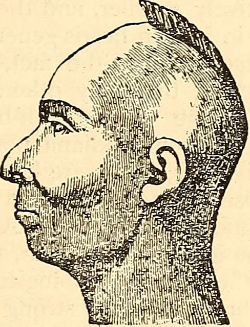 An illustration from Phrenology proved, illustrated, and applied : embracing an analysis of the primary mental powers in their various degrees of developments, the phenomena produced by their combined activity, and the location of the phrenological organs in the head : together with a view of the moral and anatomical objections to the science / by O. S. and L. N. Fowler., 1892, leaf 31