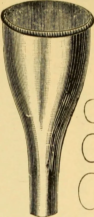 An illustration from Diseases of the ear : a text-book for practitioners and students of medicine / by Edward Bradford Dench., 1900, leaf 123